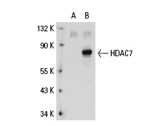 HDAC4/5/7 (H-273): sc-11421. Western blot analysis of HDAC7 expression in non-transfected: sc-110760 (A) and human HDAC7 transfected: sc-112934 (B) 293 whole cell lysates.
