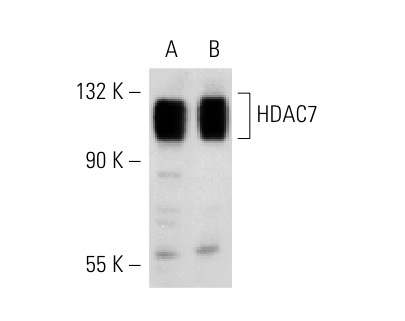 HDAC4/5/7 (H-273): sc-11421. Western blot analysis of HDAC7 expression in K-562 nuclear extract (A) and SUP-T1 whole cell lysate (B).