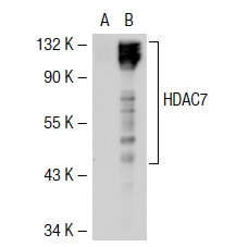 HDAC4/5/7 (H-273): sc-11421. Western blot analysis of HDAC7 expression in non-transfected: sc-117752 (A) and human HDAC7 transfected: sc-117296 (B) 293T whole cell lysates.