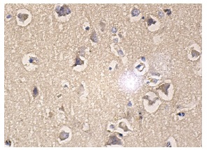 HDAC4/5/7 (H-273): sc-11421. Immunoperoxidase staining of formalin fixed, paraffin-embedded human brain tissue showing cytoplasmic staining of neuronal and glial cells.