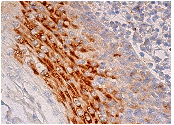 HDAC7 (N-18): sc-11489. Immunoperoxidase staining of formalin fixed, paraffin-embedded human tonsil tissue showing cytoplasmic staining of squamous epithelial cells.