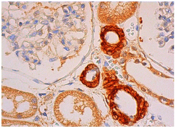 HDAC8 (N-20): sc-11544. Immunoperoxidase staining of formalin fixed, paraffin-embedded human kidney tissue showing cytoplasmic staining of cells in tubules and nuclear and cytoplasmic staining of smooth muscle cells.