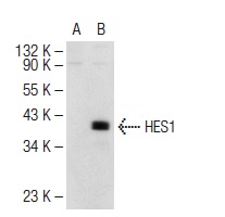 HES1 (H-20): sc-13844. Western blot analysis of HES1 expression in non-transfected: sc-117752 (A) and human HES1 transfected: sc-171319 (B) 293T whole cell lysates.