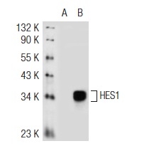 HES1 (N-17): sc-13842. Western blot analysis of HES1 expression in non-transfected: sc-117752 (A) and mouse HES1 transfected: sc-120760 (B) 293T whole cell lysates.