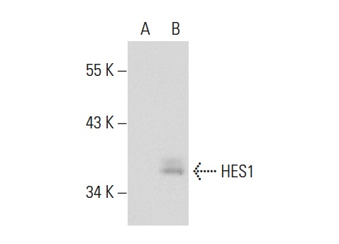 HES1 (N-17): sc-13842. Western blot analysis of HES1 expression in non-transfected: sc-117752 (A) and human HES1 transfected: sc-172124 (B) 293T whole cell lysates.