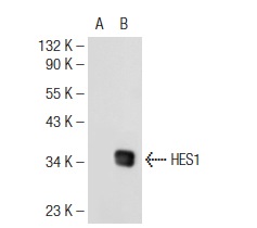 HES1 (N-17): sc-13842. Western blot analysis of HES1 expression in non-transfected: sc-117752 (A) and human HES1 transfected: sc-113854 (B) 293T whole cell lysates.