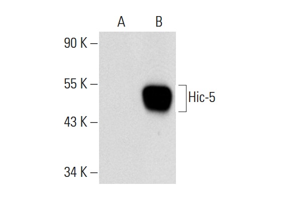 Hic-5 (F-6): sc-137051. Western blot analysis of Hic-5 expression in non-transfected: sc-117752 (A) and mouse Hic-5 transfected: sc-126953 (B) 293T whole cell lysates.