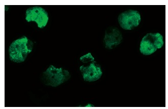 p-Histone cluster 1 H3E (Ser 10): sc-101697. Immunofluorescence staining of methanol-fixed A-431 cells showing nuclear localization.