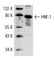 HNF-1 (H-205): sc-8986. Western blot analysis of HNF-1 expression in Hep G2 whole cell lysate.