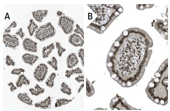 HNF-3γ (H-115): sc-25357. Immunoperoxidase staining of formalin fixed, paraffin-embedded human small intestine tissue showing nuclear staining of glandular cells at low (A) and high (B) magnification. Kindly provided by The Swedish Human Protein Atlas (HPA) program.