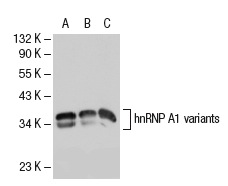 hnRNP A1 (4B10): sc-32301. Western blot analysis of hnRNP A1 expression in non-transfected 293T: sc-117752 (A), human hnRNP A1 transfected 293T: sc-111438 (B) and Jurkat (C) whole cell lysates.
