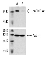 hnRNP A1 siRNA (h): sc-35575. Western blot analysis of hnRNP A1 expression in non-transfected control (A) and hnRNP A1 siRNA transfected (B) HeLa cells. Blot probed with hnRNP A1 (N-15): sc-10029. Actin (I-19): sc-1616 used as specificity and loading control.