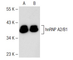 hnRNP A2/B1 (B-7): sc-374053. Western blot analysis of hnRNP A2/B1 expression in K-562 (A) and THP-1 (B) nuclear extracts.