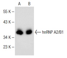 hnRNP A2/B1 (E-2): sc-374052. Western blot analysis of hnRNP A2/B1 expression in K-562 (A) and THP-1 (B) nuclear extracts.
