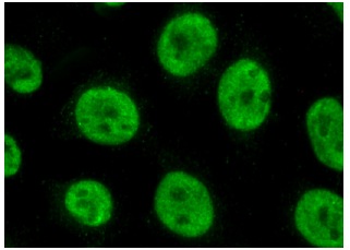 hnRNP A2/B1 (E-2): 374052. Immunofluorescence staining of methanol-fixed HeLa cells showing nuclear localization.