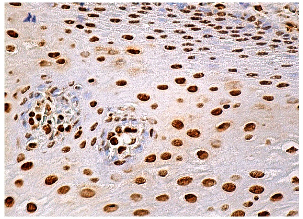 hnRNP A2/B1 (E-2): sc-374052. Immunoperoxidase staining of formalin fixed, paraffin-embedded human esophagus tissue showing nuclear staining of squamous epithelial cells.