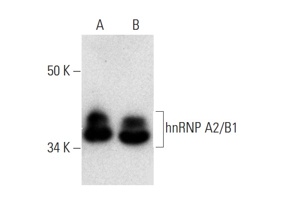 hnRNP A2/B1 (E-2): sc-374052. Western blot analysis of hnRNP A2/B1 expression in Jurkat (A) and HeLa (B) nuclear extracts.