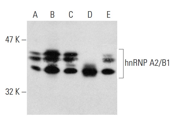 hnRNP A2/B1 (F-16): sc-10035. Western blot analysis of hnRNP A2/B1 expression in HeLa (A), K-562 (B), MEG-01 (C), THP-1 (D) and Jurkat (E) nuclear extracts.