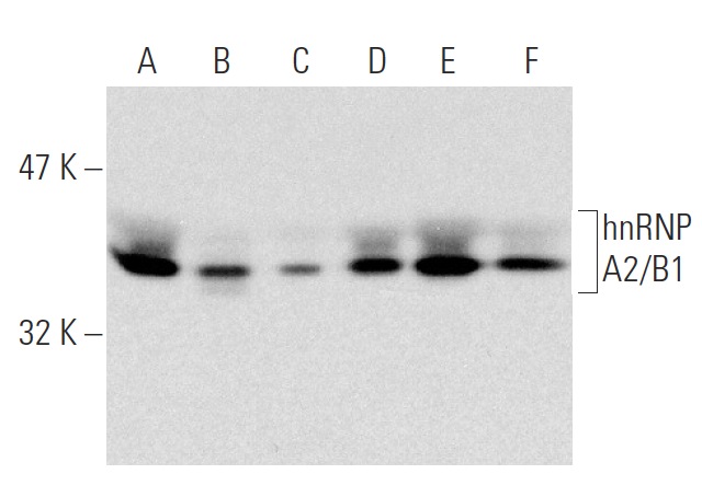 hnRNP A2/B1 (F-16): sc-10035. Western blot analysis of hnRNP A2/B1 expression in K-562 (A), MCF7 (B), PC-3 (C), HL-60 (D), MOLT-4 (E) and THP-1 (F) nuclear extracts.