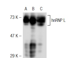 hnRNP L (4D11): sc-32317. Western blot analysis of hnRNP L expression in non-transfected: sc-117752 (A) and mouse hnRNP L transfected: sc-126967 (B) 293T whole cell lysates and Jurkat nuclear extract (C).