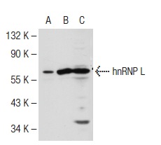 hnRNP L (D-17): sc-16550. Western blot analysis of hnRNP L expression in non-transfected 293T: sc-117752 (A), mouse hnRNP L transfected 293T: sc-126967 (B) and HeLa (C) whole cell lysates.