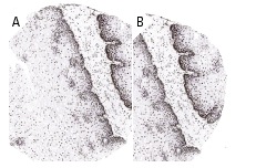hnRNP L (A-11): sc-46673. Immunoperoxidase staining of formalin fixed, paraffin-embedded human esophagus tissue showing nuclear staining of surface epithelial cells at low (A) and high (B) magnification. Kindly provided by The Swedish Human Protein Atlas (HPA) program.