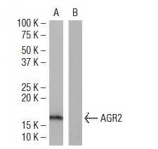 AGR2 (6C5): sc-101211 Western blot analysis of AGR2 expression in human AGR2 transfected (A) and non-transfected (B) 293T whole cell lysates.