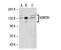 hSNF2H (H-300): sc-13054. Western blot analysis of hSNF2H expression in non-transfected 293T: sc-117752 (A), human hSNF2H transfected 293T: sc-113724 (B) and K-562 (C) whole cell lysates.