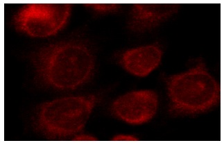 cytochrome b5 (H-114): sc-33174. Immunofluorescence staining of methanol-fixed HeLa cells showing cytoplasmic localization.