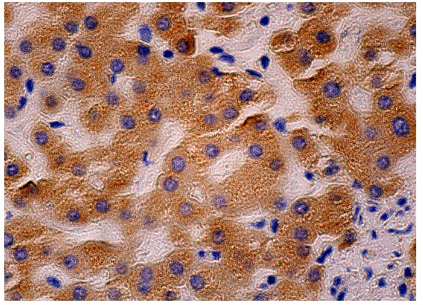 cytochrome b5 (H-114): sc-33174. Immunoperoxidase staining of formalin fixed, paraffin-embedded human liver tissue showing cytoplasmic staining of hepatocytes.