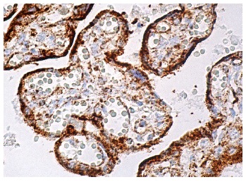 Id1 (B-8): sc-133104. Immunoperoxidase staining of formalin fixed, paraffin-embedded human placenta tissue showing cytoplasmic staining of trophoblastic cells.