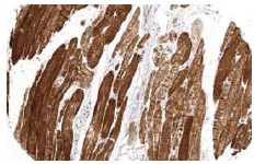 cytochrome c (A-8): sc-13156. Immunoperoxidase staining of formalin fixed, paraffin-embedded human skeletal muscle tissue showing cytoplasmic staining of myocytes. Kindly provided by The Swedish Human Protein Atlas (HPA) program.