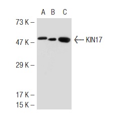 KIN17 (K36): sc-32768. Western blot analysis of KIN17 expression in non-transfected 293T: sc-117752 (A), mouse KIN17 transfected 293T: sc-127043 (B) and Jurkat (C) whole cell lysates.