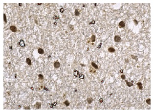 LIN-28 (H-44): sc-67266. Immunoperoxidase staining of formalin fixed, paraffin-embedded human brain tissue showing nuclear staining of neuronal and glial cells.