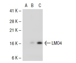 LMO4 (C-15): sc-11122. Western blot analysis of LMO4 expression in non-transfected 293T: sc-117752 (A), mouse LMO4 transfected 293T: sc-121361 (B) and IMR-32 (C) whole cell lysates.