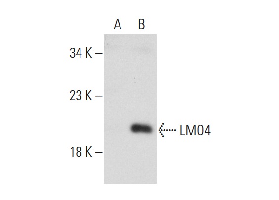 LMO4 (C-15): sc-11122. Western blot analysis of LMO4 expression in non-transfected: sc-117752 (A) and mouse LMO4 transfected: sc-110226 (B) 293T whole cell lysates.