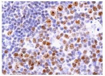 Lsh (H-4): sc-46665. Immunoperoxidase staining of formalin fixed, paraffin-embedded human tonsil tissue showing nuclear staining of subset of cells in germinal center.
