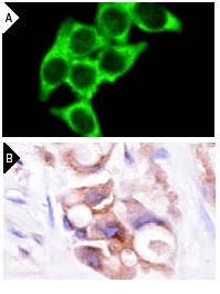 DAP-5 (G-20): sc-13736. Immunofluorescence staining of methanol-fixed HeLa cells (A) and immunoperoxidase staining of formalin-fixed, paraffin-embedded human breast tumor (B) showing cytoplasmic staining.