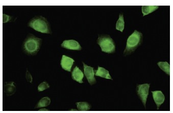 LZTFL1 (35-Y): sc-100968. Immunofluorescence staining of paraformaldehyde-fixed HeLa cells showing cytoplasmic localization.