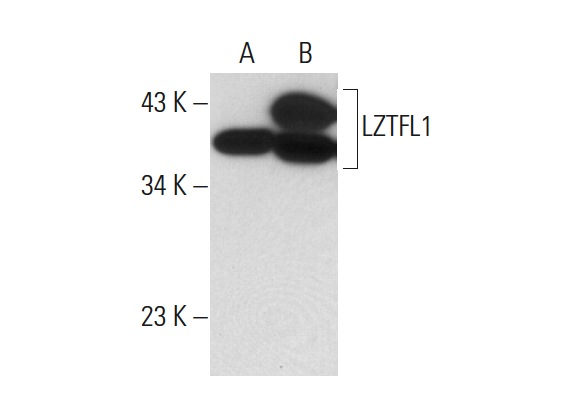LZTFL1 (35-Y): sc-100968. Western blot analysis of LZTFL1 expression in non-transfected: sc-117752 (A) and human LZTFL1 transfected: sc-172211 (B) 293T whole cell lysates.