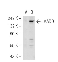 MADD (H-300): sc-98434. Western blot analysis of MADD expression in non-transfected: sc-117752 (A) and mouse MADD transfected: sc-127119 (B) 293T whole cell lysates.