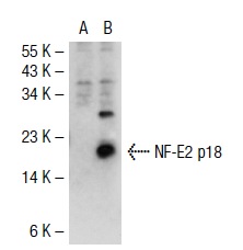 MafF/G/K (H-100): sc-22831. Western blot analysis of NF-E2 p18 (MafK) expression in non-transfected: sc-117752 (A) and mouse NF-E2 p18 transfected: sc-122032 (B) 293T whole cell lysates.
