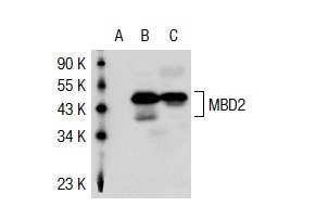 MBD2 (H-70): sc-10752. Western blot analysis of MBD2 expression in non-transfected 293T: sc-117752 (A), human MBD2 transfected 293T: sc-115236 (B) and Jurkat (C) whole cell lysates.