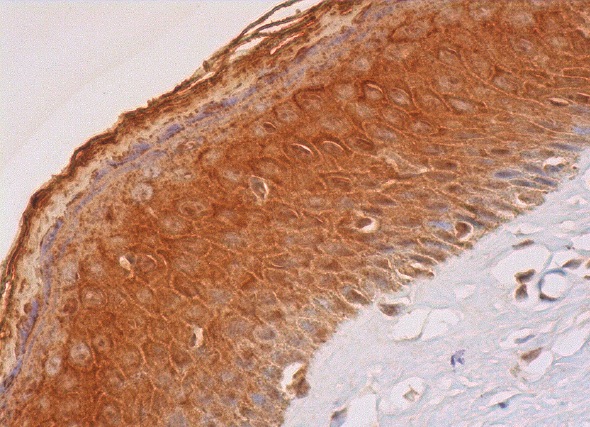 MBD2 (H-70): sc-10752. Immunoperoxidase staining of formalin fixed, paraffin-embedded human vulva/anal skin tissue showing cytoplasmic and nuclear staining of epidermal cells.