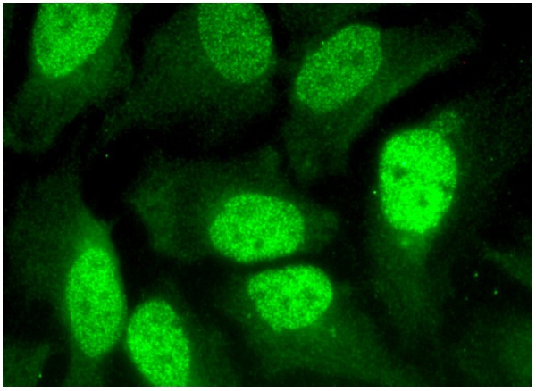 MBD2 (H-70): sc-10752. Immunofluorescence staining of methanol-fixed HeLa cells showing nuclear localization.