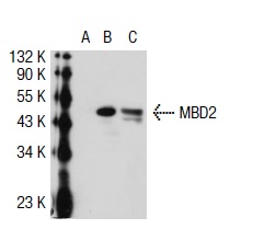 MBD2 (N-18): sc-9397. Western blot analysis of MBD2 expression in non-transfected 293T: sc-117752 (A), human MBD2 transfected 293T: sc-115236 (B) and Jurkat (C) whole cell lysates.