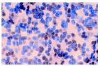 MEF-2 (C-21): sc-313. Immunoperoxidase staining of formalin-fixed, paraffin-embedded mouse brain tissue showing nuclear localization.