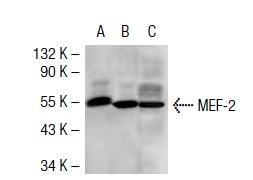 MEF-2 (C-21): sc-313. Western blot analysis of MEF-2 expression in non-transfected 293T: sc-117752 (A), human MEF-2 transfected 293T: sc-116507 (B) and Daudi (C) whole cell lysates.