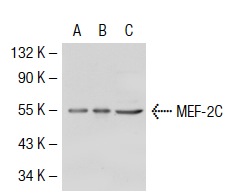 MEF-2 (C-21): sc-313. Western blot analysis of MEF-2C expression in non-transfected 293T: sc-117752 (A), mouse MEF-2C transfected 293T: sc-121587 (B) and SK-N-SH (C) whole cell lysates.