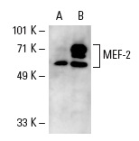 MEF-2 (C-21): sc-313. Western blot analysis of MEF-2 expression in non-transfected: sc-110760 (A) and human MEF-2 transfected: sc-111308 (B) 293 whole cell lysates.